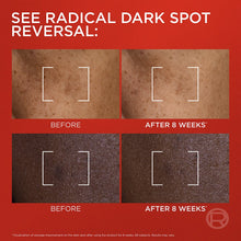 Cargar imagen en el visor de la galería, Loreal Triple Power Melasyl Dark Spot Creamy Serum anti edad contra manchas
