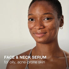 Cargar imagen en el visor de la galería, Neutrogena Stubborn Texture Serum Niacinamida