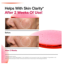 Cargar imagen en el visor de la galería, Anua Niacinamide 10 + Txa 4 Serum