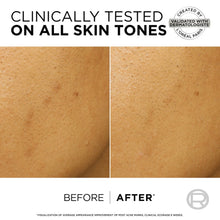 Cargar imagen en el visor de la galería, Loreal Bright Reveal Dark Spot Exfoliant Peel