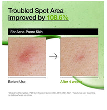 Cargar imagen en el visor de la galería, Anua Azelaic Acid 10+ Hyaluron Serum
