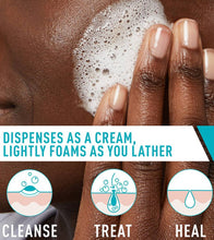 Cargar imagen en el visor de la galería, Cerave Acne Foaming Cream Cleanser 4% Benzoyl