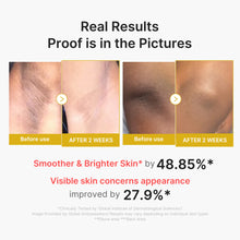 Cargar imagen en el visor de la galería, Medicube Kojic Acid Turmeric Body Peel Shot