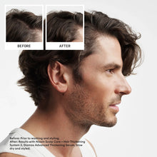 Cargar imagen en el visor de la galería, Nioxin 2 Scalp Care + Hair Thickening System