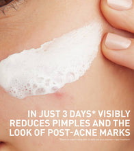 Cargar imagen en el visor de la galería, Cerave Acne Clay To Foam Cleanser Limpiador Facial
