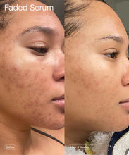 Cargar imagen en el visor de la galería, Topicals Faded Brightening & Clearing Serum