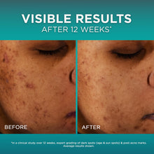 Cargar imagen en el visor de la galería, Loreal Bright Reveal Serum de Niacinamida Dark Spot