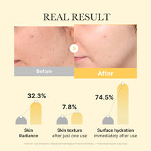 Cargar imagen en el visor de la galería, Medicube Kojic Acid Turmeric Brightening Gel Mask
