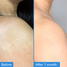 Cargar imagen en el visor de la galería, Good Molecules crema para manchas corporal
