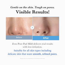 Cargar imagen en el visor de la galería, Medicube Zero Pore Pad Mild
