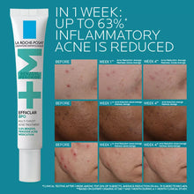 Cargar imagen en el visor de la galería, La Roche Posay Effaclar Bpo Acne Treatment 5.5% Benzoyl Peroxide

