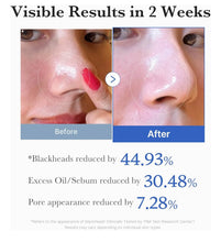 Cargar imagen en el visor de la galería, Medicube Zero Pore Pads
