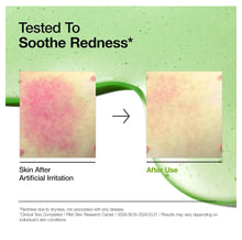 Cargar imagen en el visor de la galería, Anua Azelaic Acid 10+ Hyaluron Serum
