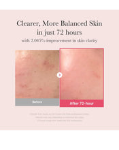 Cargar imagen en el visor de la galería, Medicube Txa Niacinamide 15 % Serum
