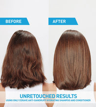 Cargar imagen en el visor de la galería, Cerave Anti-Dandruff Hydrating Conditioner
