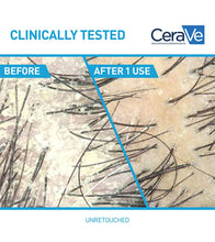 Cargar imagen en el visor de la galería, Cerave Anti-Dandruff Hydrating Shampoo
