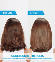 Cargar imagen en el visor de la galería, Cerave Anti-Dandruff Hydrating Shampoo
