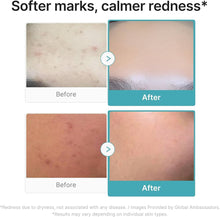 Cargar imagen en el visor de la galería, Medicube Azelaic Acid 10 BB Soothing Serum 10%
