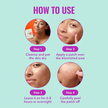 Cargar imagen en el visor de la galería, Good Molecules Pimple Patches Parches para acné
