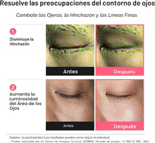 Cargar imagen en el visor de la galería, Abib PDRN Retinal Eye Patch
