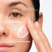 Cargar imagen en el visor de la galería, La Roche Posay Effaclar Duo Dual Action Acne Cleanser Limpiador Facial
