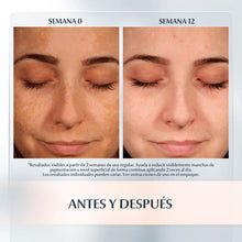 Cargar imagen en el visor de la galería, Eucerin Anti Pigment Hidratante spf 30 para manchas
